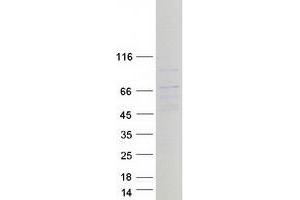 Western Blotting (WB) image for Chromosome 6 Open Reading Frame 150 (C6orf150) protein (Myc-DYKDDDDK Tag) (ABIN2715538)