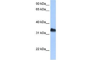 DND1 antibody used at 0. (DND1 Antikörper)