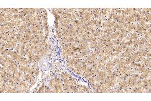 Immunohistochemistry (IHC) image for anti-Insulin Receptor (INSR) antibody (ABIN7427843)