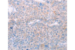 Immunohistochemistry (IHC) image for anti-Spermatogenesis Associated 6 (SPATA6) antibody (ABIN2422311) (SPATA6 Antikörper)