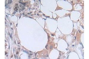 Immunohistochemistry (IHC) image for anti-Phosphoglycerate Kinase 1 (PGK1) (AA 2-417) antibody (ABIN7436240)