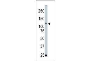 The anti-LOK Pab (ABIN392476 and ABIN2842057) is used in Western blot to detect LOK in Jurkat cell lysate. (STK10-A Antikörper  (C-Term))