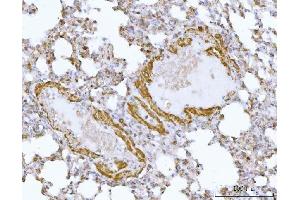 IHC analysis of DTR/HBEGF using anti-DTR/HBEGF antibody (ABIN7603042).