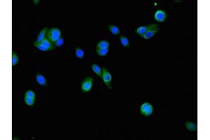 Immunofluorescent analysis of HepG2 cells using ABIN7152911 at dilution of 1:100 and Alexa Fluor 488-congugated AffiniPure Goat Anti-Rabbit IgG(H+L) (FSIP2 Antikörper  (AA 5530-5824))