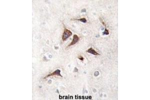 Immunohistochemistry (IHC) image for anti-Calcium/calmodulin-Dependent Protein Kinase II delta (CAMK2D) antibody (ABIN5023065) (CAMK2D Antikörper)