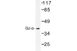 Image no. 1 for anti-Guanine Nucleotide Binding Protein (G Protein), alpha Z Polypeptide (GNaZ) antibody (ABIN317793) (GNaZ Antikörper)