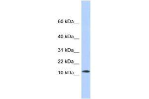 WB Suggested Anti-MAP1LC3A Antibody Titration:  0. (MAP1LC3A Antikörper  (N-Term))