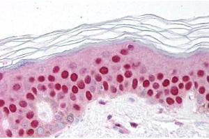 Human Skin (formalin-fixed, paraffin-embedded) stained with GDF9 antibody ABIN214650 at 10 ug/ml followed by biotinylated goat anti-rabbit IgG secondary antibody ABIN481713, alkaline phosphatase-streptavidin and chromogen. (GDF9 Antikörper  (AA 45-59))