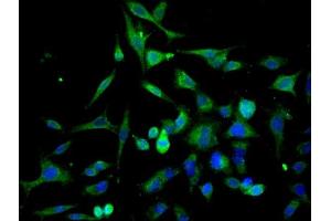 Immunofluorescence (Cultured Cells) (IF (cc)) image for anti-Cathepsin L1 (CTSL1) (AA 71-170) antibody (ABIN687532)