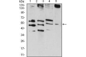 Western blot analysis using RAD52 mouse mAb against HepG2 (1), MCF-7 (2), MCF-7 (3), and C6 (4) cell lysate. (RAD52 Antikörper  (AA 269-418))