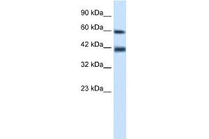 WB Suggested Anti-TRIM31 Antibody Titration:  0. (TRIM31 Antikörper  (N-Term))