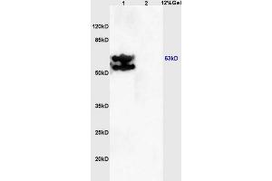 Lane 1: mouse embryo lysates Lane 2: mouse brain lysates probed with Anti PRKAG2/AMPK? (AMPK gamma 1/2/3 (AA 280-330) Antikörper)