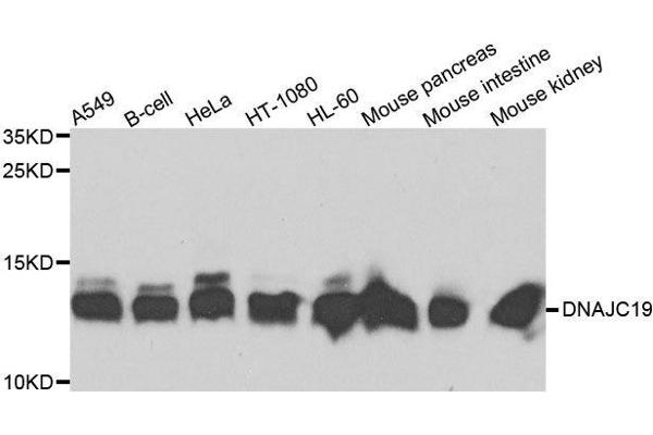 DNAJC19 Antikörper  (AA 1-116)