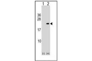 Western blot analysis of PLA2G12A (arrow) using PLA2G12A Antibody (Center) Cat. (PLA2G12A Antikörper  (Middle Region))