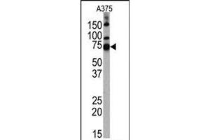 Western blot analysis of HDAC10 polyclonal antibody  in A-375 cell line lysates. (HDAC10 Antikörper  (AA 1-100))