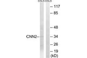 Western Blotting (WB) image for anti-Calponin 2 (CNN2) (AA 121-170) antibody (ABIN2890176) (CNN2 Antikörper  (AA 121-170))