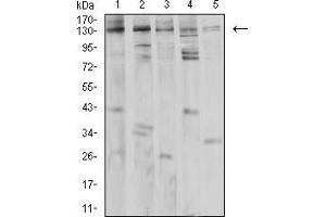 Western Blotting (WB) image for anti-phospholipase C, gamma 1 (PLCG1) (AA 39-181) antibody (ABIN5542682)