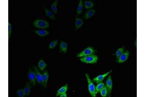 Immunofluorescent analysis of HepG2 cells using ABIN7145472 at dilution of 1:100 and Alexa Fluor 488-congugated AffiniPure Goat Anti-Rabbit IgG(H+L) (beta Defensin 1 Antikörper  (AA 33-68))