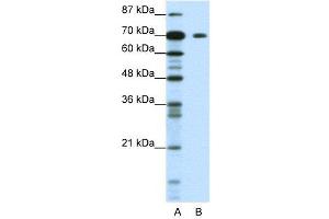 WB Suggested Anti-KLHL26  Antibody Titration: 1. (KLHL26 Antikörper  (C-Term))