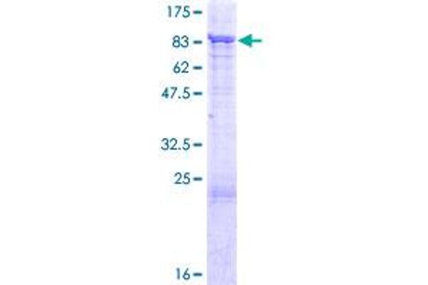 PIAS2 Protein (AA 1-572) (GST tag)