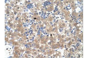 PEX3 antibody was used for immunohistochemistry at a concentration of 4-8 ug/ml. (PEX3 Antikörper  (N-Term))