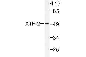 Image no. 1 for anti-Activating Transcription Factor 2 (ATF2) antibody (ABIN265321) (ATF2 Antikörper)