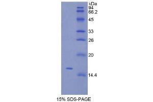 SDS-PAGE (SDS) image for Thymic Stromal Lymphopoietin (TSLP) (AA 75-196) protein (His tag) (ABIN1080909)