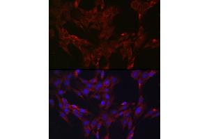 Immunofluorescence analysis of C6 cells using DUSP6 Rabbit pAb (ABIN3017520, ABIN3017521, ABIN3017522 and ABIN6220131) at dilution of 1:100 (40x lens). (DUSP6 Antikörper  (AA 1-170))