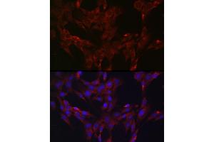 Immunofluorescence analysis of C6 cells using DUSP6 Rabbit pAb (ABIN3017520, ABIN3017521, ABIN3017522 and ABIN6220131) at dilution of 1:100 (40x lens). (DUSP6 Antikörper  (AA 1-170))