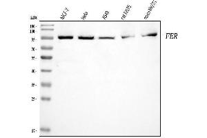 Western blot analysis of FER using anti-FER antibody (ABIN7599553).