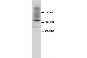 Western Blotting (WB) image for anti-Heat Shock 60kDa Protein 1 (Chaperonin) (HSPD1) antibody (ABIN1107605) (HSPD1 Antikörper)