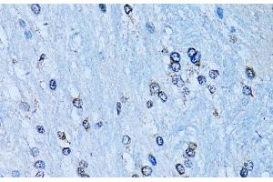 Immunohistochemistry of paraffin-embedded Rat brain using NFkB p100 / p52 Polyclonal Antibody at dilution of 1:100 (40x lens). (NFKB2 Antikörper)
