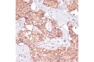 Immunohistochemistry (IHC) image for anti-Translocase of Inner Mitochondrial Membrane 8 Homolog B (TIMM8B) (AA 16-98) antibody (ABIN7270928)