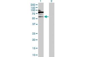 Western Blot analysis of RORC expression in transfected 293T cell line by RORC MaxPab polyclonal antibody. (RORC Antikörper  (AA 1-518))
