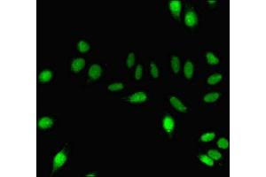 Immunofluorescent analysis of A549 cells using ABIN7150825 at dilution of 1:100 and Alexa Fluor 488-congugated AffiniPure Goat Anti-Rabbit IgG(H+L) (Dynamin 1 Antikörper  (AA 2-245))