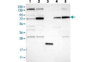 Western blot analysis of Lane 1: RT-4, Lane 2: U-251 MG, Lane 3: Human Plasma, Lane 4: Liver, Lane 5: Tonsil with DNAJC14 polyclonal antibody  at 1:250-1:500 dilution. (DNAJC14 Antikörper)