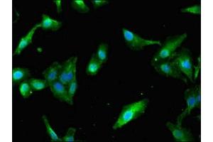 Immunofluorescent analysis of Hela cells using ABIN7163786 at dilution of 1:100 and Alexa Fluor 488-congugated AffiniPure Goat Anti-Rabbit IgG(H+L) (PAIP2 Antikörper  (AA 1-127))