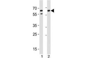 CD46 antibody western blot analysis in A549,HeLa lysate (CD46 Antikörper  (AA 330-361))
