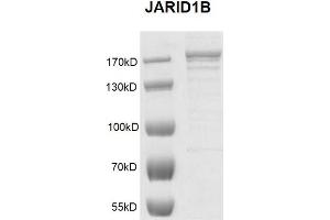 Recombinant JARID1B / KDM5B protein gel.