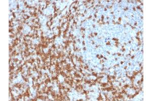 Formalin-fixed, paraffin-embedded human Tonsil stained with CD5 Mouse Monoclonal Antibody (CD5/2419). (CD5 Antikörper  (AA 269-366))