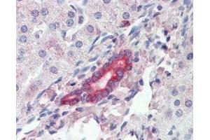 IHC testing of FFPE human liver tissue with ROR1 antibody at 3ug/ml. (ROR1 Antikörper)