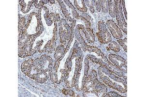 IHC analysis of GLUD1/2 using anti-GLUD1/2 antibody (ABIN7602000). (GLUD1 / GLUD2 (AA 54-553) Antikörper)