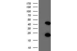 Western Blotting (WB) image for anti-Centromere Protein H (CENPH) antibody (ABIN1497473) (CENPH Antikörper)