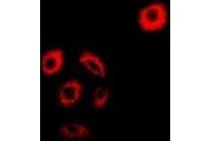 Immunofluorescent analysis of AMPK beta 2 staining in MCF7 cells. (PRKAB2 Antikörper)