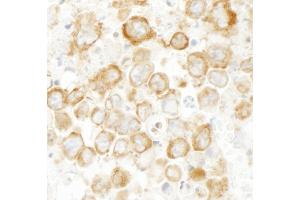 Immunohistochemistry (IHC) image for anti-Cytoskeleton-Associated Protein 4 (CKAP4) (AA 500-550) antibody (ABIN7448940) (CKAP4 Antikörper  (AA 500-550))