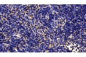 Immunohistochemistry (IHC) image for anti-Toll-Like Receptor 5 (TLR5) (AA 303-514) antibody (ABIN7438082)