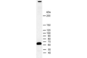 dilution: 1 : 2000, sample: rat brain homogenate (Piccolo Antikörper  (AA 4439-4776))