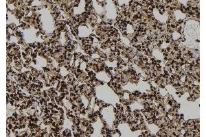 ABIN6272551 at 1/100 staining Rat lung tissue by IHC-P. (PPP1R9B Antikörper  (C-Term))