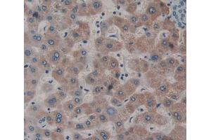 IHC-P analysis of liver tissue, with DAB staining. (Dystonin Antikörper  (AA 1-252))