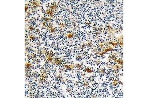 Immunohistochemical analysis of DOK6 staining in human lymph node formalin fixed paraffin embedded tissue section.